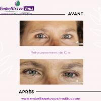 Rehaussement de Cils